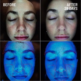 Exfoliante Facial Renovador De Microdermoabrasión Dr. Brandt                                                                                          