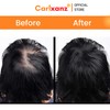 Carlxanz Hair Fiber Classic (4 x 25g)