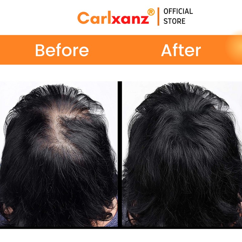 Carlxanz Hair Fiber Classic (4 x 25g)