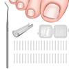 Ingrown Toenails Set, Toenail Correction Patch, Nail Clip, Toenails, Ingrown