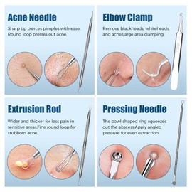 PORAYATA Blackhead Remover Tool Kit, 6 Pcs Pimple Popper Comedone Extractor Set with Acne Needles, Tweezers, Pore Scraper for Blemish, Zit, Whitehead Removal on Nose and Face, with Storage Case