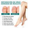 Crema Para Eliminar Hongos En Uñas De Manos , Pies