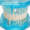 LVCHEN - Modelo de dientes de implante dental transparente, modelo