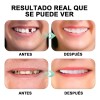 Dientes Postizos Temporal Falsos Carillas Dentales