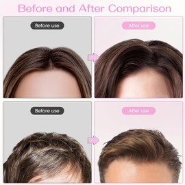 4PCS Volume Hair Clips for Fluffy Bangs,Volume Clip for Hairline,Wind Shaping Styling Comb,Hair Roots Lifting Clips,High Crown Volume Tools Set,No-Trace Hair Root Curlers for Men and Women