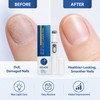 Portable Nail Care Pen for Women – Blue Light Grooming