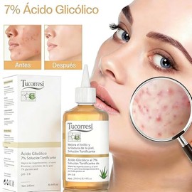 Tónico Facial con Ácido Glicólico al 7%: Exfoliante Químico para Puntos Negros, Poros y Acné - 240ml para Piel Grasa y Mixta, Elimina Manchas y Arruga