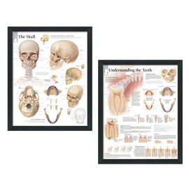 Set of 2 Framed Medical Posters The Skull and Understanding The Teeth 22”x28” Wall Diagrams Educational Informational Doctors Office Charts