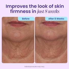 goPure-Crema reafirmante para el cuello: crema antienvejecimiento para el cuello que tensa y elimina las arrugas para lograr un tono de piel uniforme 