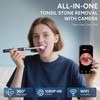 Tonsil Stone Remover with Camera - Upgraded Visual Tonsil Stone