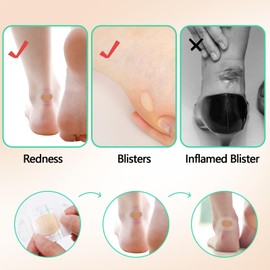 80pcs Oval Blister Bandage,Blister Guard Heel Pads Hydrocolloid Bandages, Waterproof Bandages Protection Patches for Toes, Blister Prevention, Heel