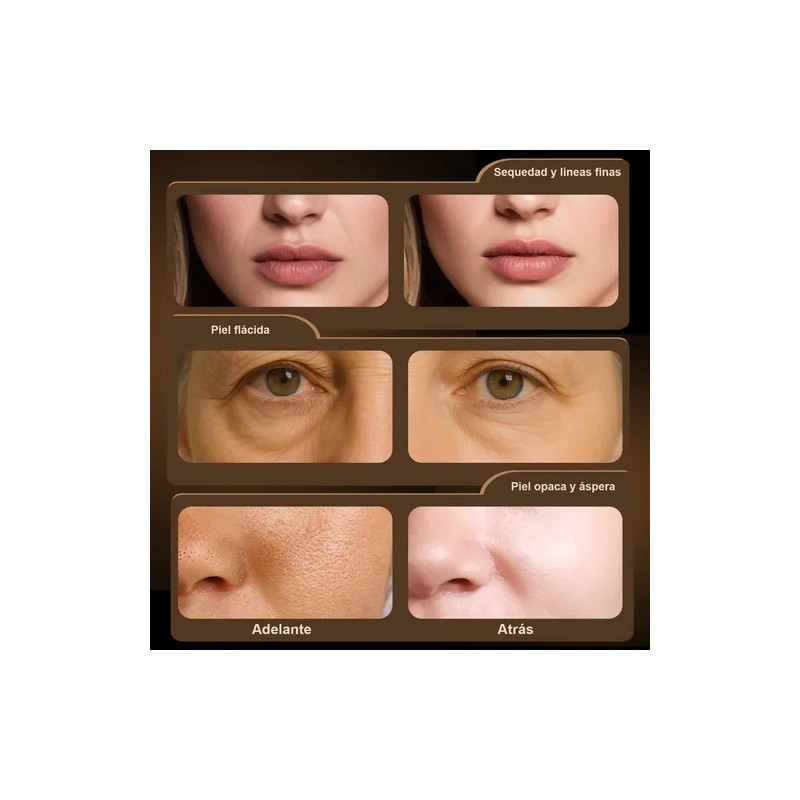 Serum Facial Retinol Antiarrugas Con Ceramida+ Squalane 30ml