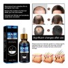 Aceite Crecimiento Cabello