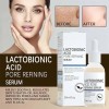 Ee Serum Acido Lactobionico Reductor Y Cierre De Poros Momento