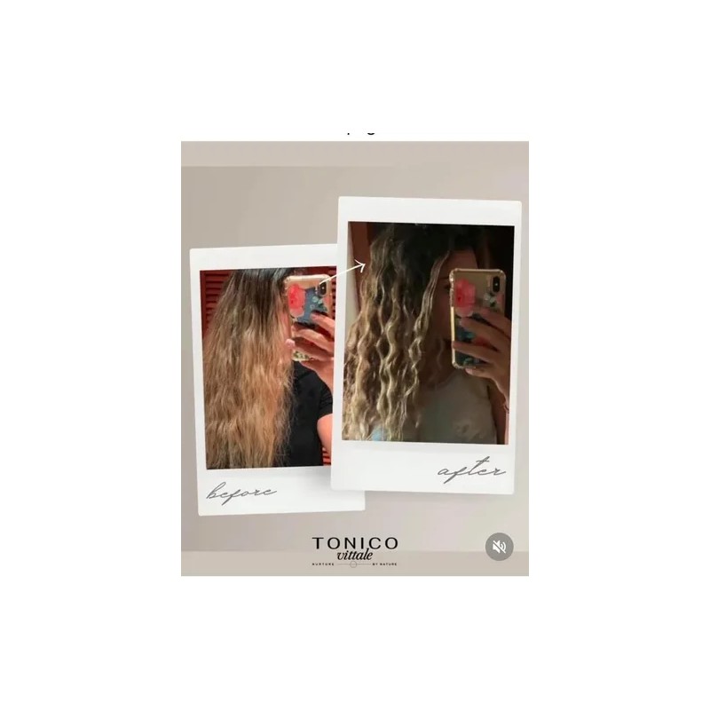 Paquete Tónico Y Shampoo Para Cabello Graso Tónico Vittale