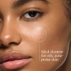 Neutro Oil-free Acne Face Wash - Facial Cleanser With