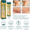 Wound Healing Ointment, Relieve Skin Abrasions, Promote Wound Healing
