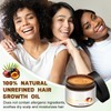 YAQIMIYA 100% Natural Raw Batana Oil for Hair Growth, Dr