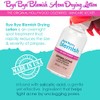 Bye Bye Blemish For Acne Drying Lotion 1 oz (