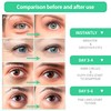 BREYLEE Rose Eye Mask– 60 Pcs, Under Eye Patches,Eye Patches