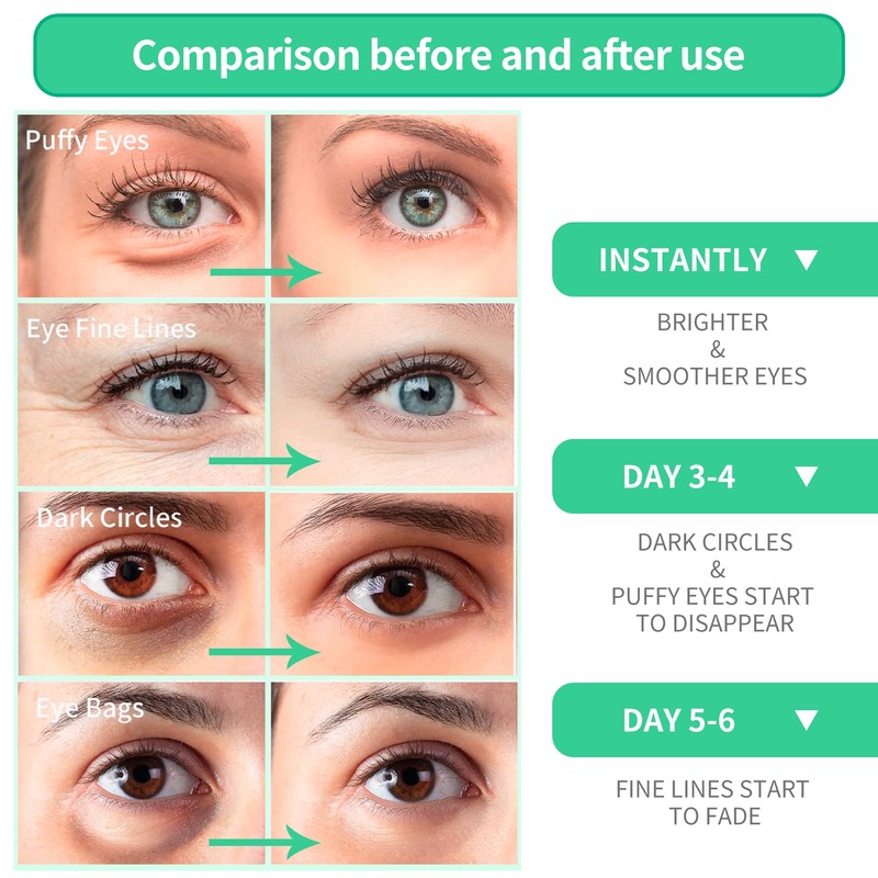 BREYLEE Rose Eye Mask– 60 Pcs, Under Eye Patches,Eye Patches