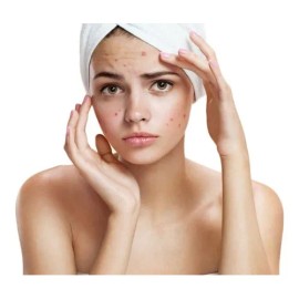 Gel Dalatin Barros Espinilla Acn Piel Grasa Clindamicina 1g                                                                                           