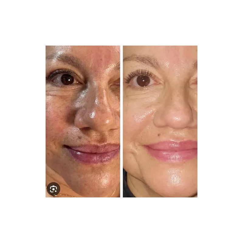 Crema Carotone 135 Ml Antimanchas Cutis Limpio