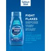 Selsun Blue Normal-Oily Hair Anti-Dandruff Shampoo, 300 mL, Helps Control