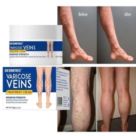 DERMFREE Treatment Legs Varicose Veins Cream Vein Care Fading Cream Herbal Ointment 60g