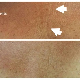 Morganna’s Bellatox Anti-Aging Gel Serum – Hyaluronic Acid Flower Moisturizer for Radiant, Tightened & Hydrated Skin