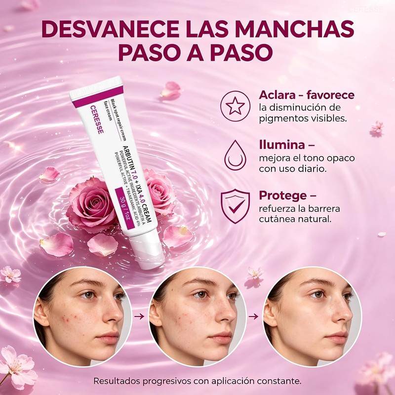 Crema Iluminadora con Arbutina 7% y Ácido Tranexámico 4%