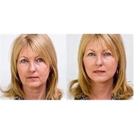 ART HARDING'S Instant Face and Neck Lift (Dark)