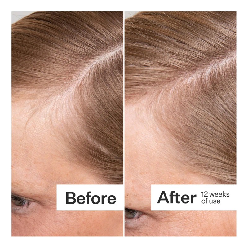Act+ Acre Cápsulas Para Cabello Grueso Y Fuerte 60 N/a