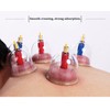 Kangzhu 24-Cup Biomagnetic Chinese Cupping Therapy Set