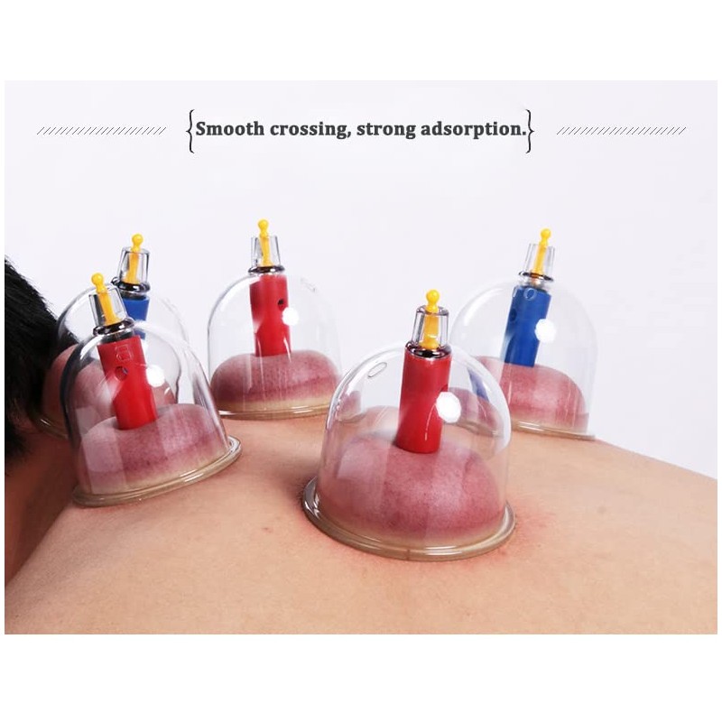 Kangzhu 24-Cup Biomagnetic Chinese Cupping Therapy Set