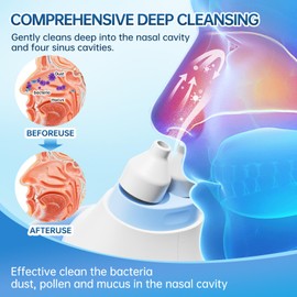 JBKhrodric Nasal Irrigation System,Nasal irrigator,Sinus Rinse Machine, Nasal Rinse Machine,2 Modes Nose Cleaner with Auto Waste Collection Function for Sinus, Runny Nose, Nasal Congestion