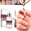 1PC Nail Treatment Nail Renewal Solution Toenails & Fingernails Repairs Essential Oil Protects From Discoloration, Brittle And Cracked (12ML)
