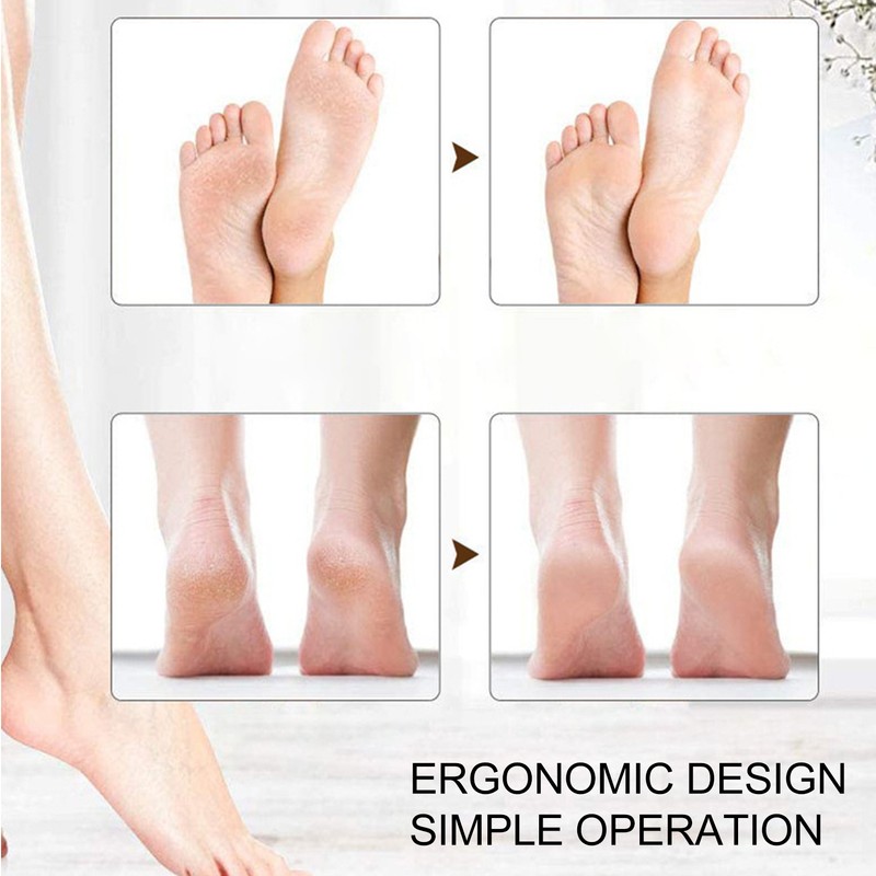 Electric Foot Grinder 2 Levels Speed Adjustment Ergonomic Design USB