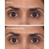 Murad Retinol Youth Renewal Eye Masks 5 Packs