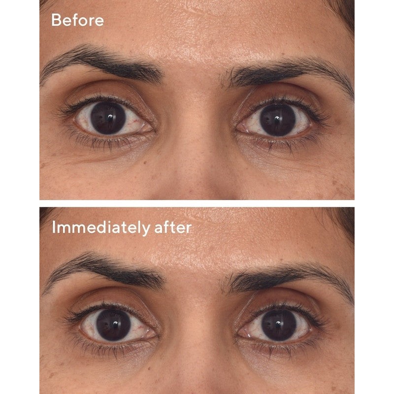 Murad Retinol Youth Renewal Eye Masks 5 Packs