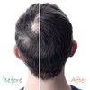 Champú y acondicionador para el crecimiento del cabello 2 en