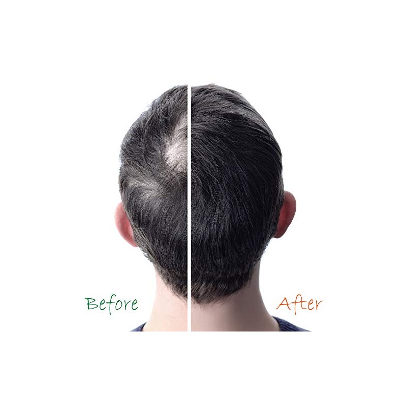 Champú y acondicionador para el crecimiento del cabello 2 en