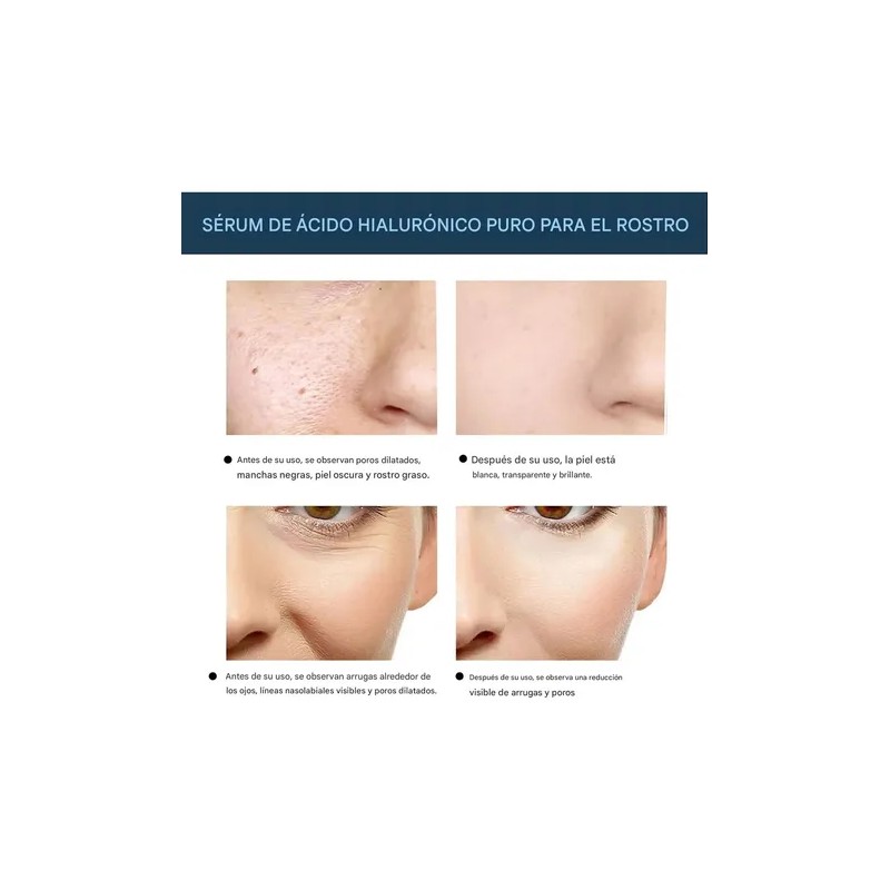 240pzs Hilos Colágeno Solubles Hidrolizado Absorbibles