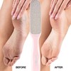 Probelle Double-Sided Nickel Foot File Callus Remover – Multidirectional Design