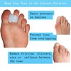 MENOCADY Pack of 12 Gel Toe Separator, (1/4" Thick) Big