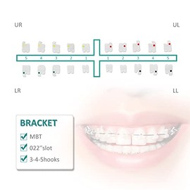 10 Paquetes de Soportes Dentales Ortodónticos de Cerámica, Brackets MBT/Roth de 022" Ranura 345 con Gancho (Soporte MBT)