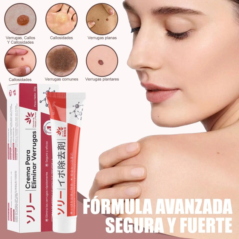 Crema Para Verrugas Elimina Eficazmente Y Cuida La Piel 30g