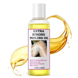 Chemical Peel for Face - Peeling Oil for Facial & Body Exfoliating with 16% Salicylic Acid - Dead Skin Remover with Gentle Formula for All Skin Type - 110mL(3.66OZ)