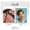 Cre-C Loción Regeneradora Capilar Anticaida de Cabello Lab Capixyl De125