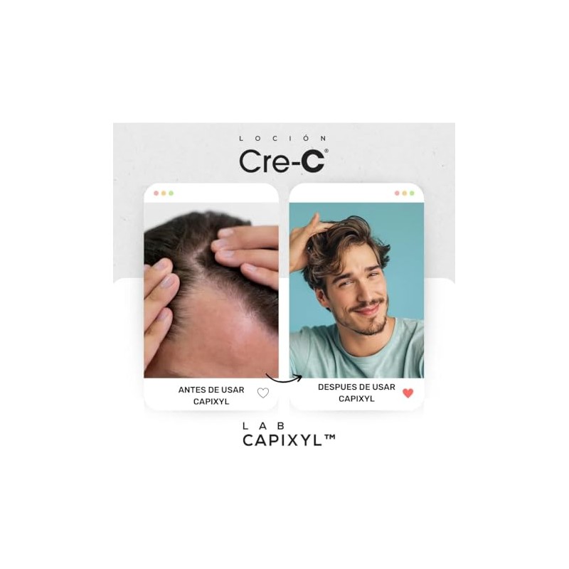 Cre-C Loción Regeneradora Capilar Anticaida de Cabello Lab Capixyl De125